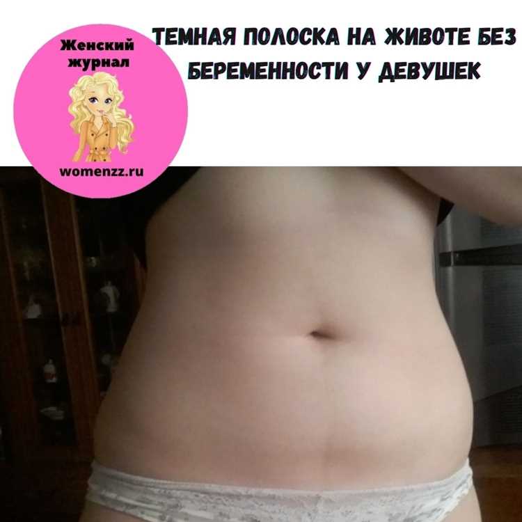 Наследственность и ее влияние на образование полоски